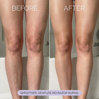 Rema- Body Hair Removal Spray
