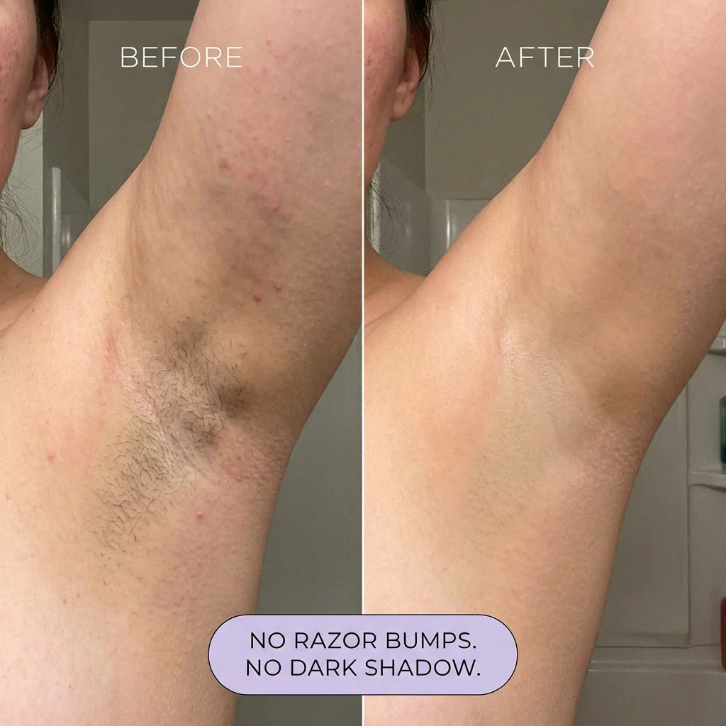 Rema- Body Hair Removal Spray