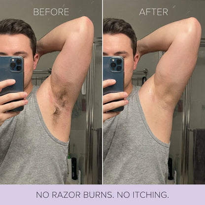 Rema- Body Hair Removal Spray