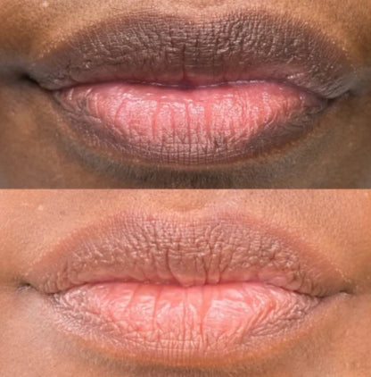 Rema™ Dark Lip Peel-Off Mask